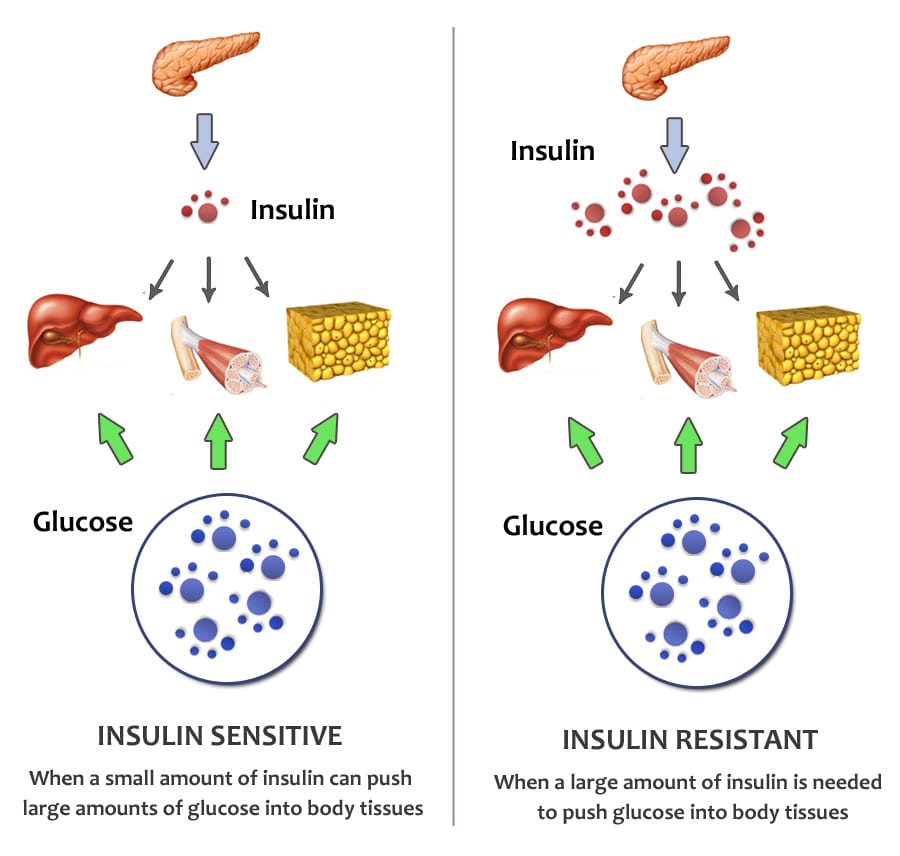 do-keto-diets-increase-insulin-resistance-team-wild